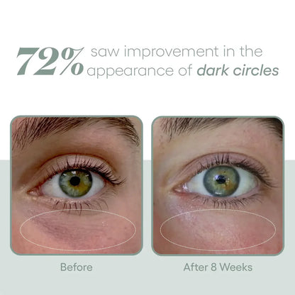 EYE Serum